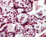 AP09451PU-N - HMGA1 / HMGIY
