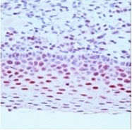 DM336P - ERCC1