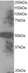 AP16268PU-N - TXNDC5 / TLP46