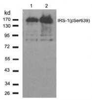 AP02489PU-S - IRS1