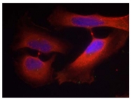 AP09459PU-S - Cytokeratin 8