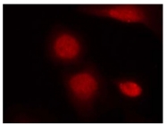 AP08008PU-N - Androgen receptor