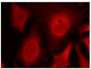 AP08033PU-N - EIF2A / EIF2S1