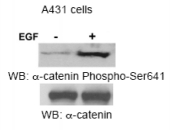 AP08076PU-S - Catenin alpha-1 / CTNNA1