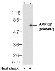 AP02451PU-S - PRKAA1