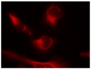 AP08005PU-S - MAPT / TAU
