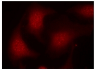 AP02418PU-S - Retinoblastoma-associated protein / RB1