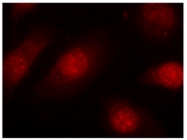 AP02420PU-S - Retinoblastoma-associated protein / RB1