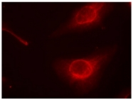 AP02426PU-S - Cofilin-1