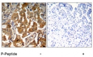 AP02458PU-S - Alpha-Adducin / ADD1