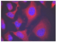 AP02458PU-S - Alpha-Adducin / ADD1