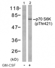 AP02506PU-S - RPS6KB1 / STK14A