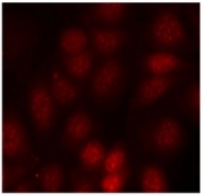 AP02506PU-S - RPS6KB1 / STK14A
