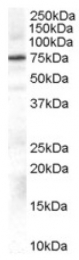 AP16462PU-N - Beta-ARK-1 / ADRBK1