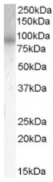 AP16454PU-N - PDE4B