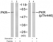 AP02523PU-S - EIF2AK2 / PKR