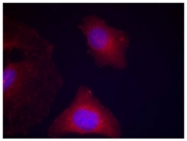 AP02535PU-S - GSK3 beta