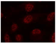 AP02538PU-S - MAPKAP Kinase-2