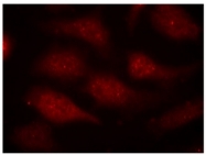 AP08040PU-S - CDK6