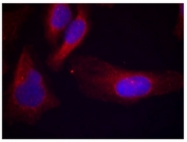 AP08042PU-N - CBL / RNF55