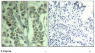 AP08042PU-N - CBL / RNF55