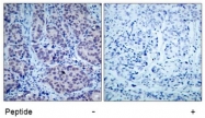 AP02667PU-N - HDAC2