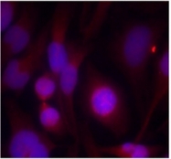 AP02667PU-N - HDAC2