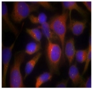 AP02680PU-N - Myosin light chain 2 (MYL2)