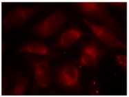AP02697PU-S - RPS6KB1 / STK14A