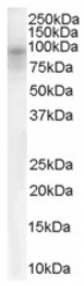 AP16364PU-N - DPP10 / DPRP3