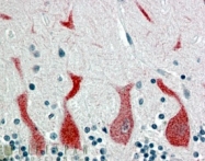 AP16336PU-N - RAR-alpha / RARA