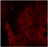 AP02795PU-N - PTPN6