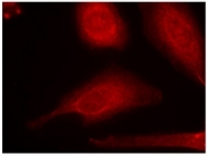 AP08075PU-N - SMAD3