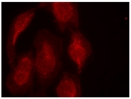 AP08101PU-S - CDK6