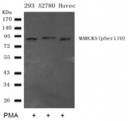 AP09469PU-S - MARCKS