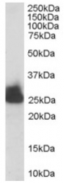 AP16324PU-N - Triosephosphate isomerase (TPI1)
