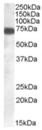 AP16323PU-N - ZDHHC13