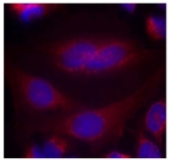 AP09475PU-N - Alpha-Synuclein / SNCA