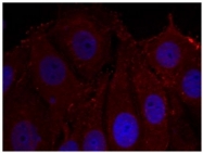 AP09477PU-S - Alpha-Synuclein / SNCA