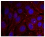 AP09478PU-N - Alpha-Synuclein / SNCA