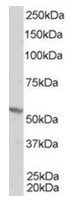 AP16283PU-N - RXR-beta / RXRB