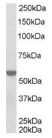 AP16282PU-N - RXR-alpha / RXRA