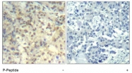 AP09483PU-N - Cofilin-1