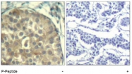 AP09484PU-N - Cofilin-1+2