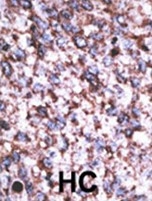 AP13070PU-N - BACE2