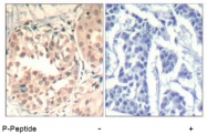 AP09488PU-N - CDK6
