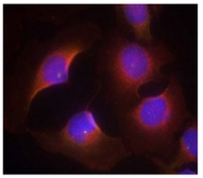 AP09488PU-N - CDK6