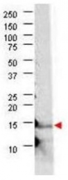 AP09162PU-S - Interleukin-21 / IL21