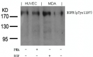AP09496PU-N - EGFR / ERBB1