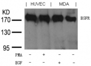 AP09518PU-N - EGFR / ERBB1